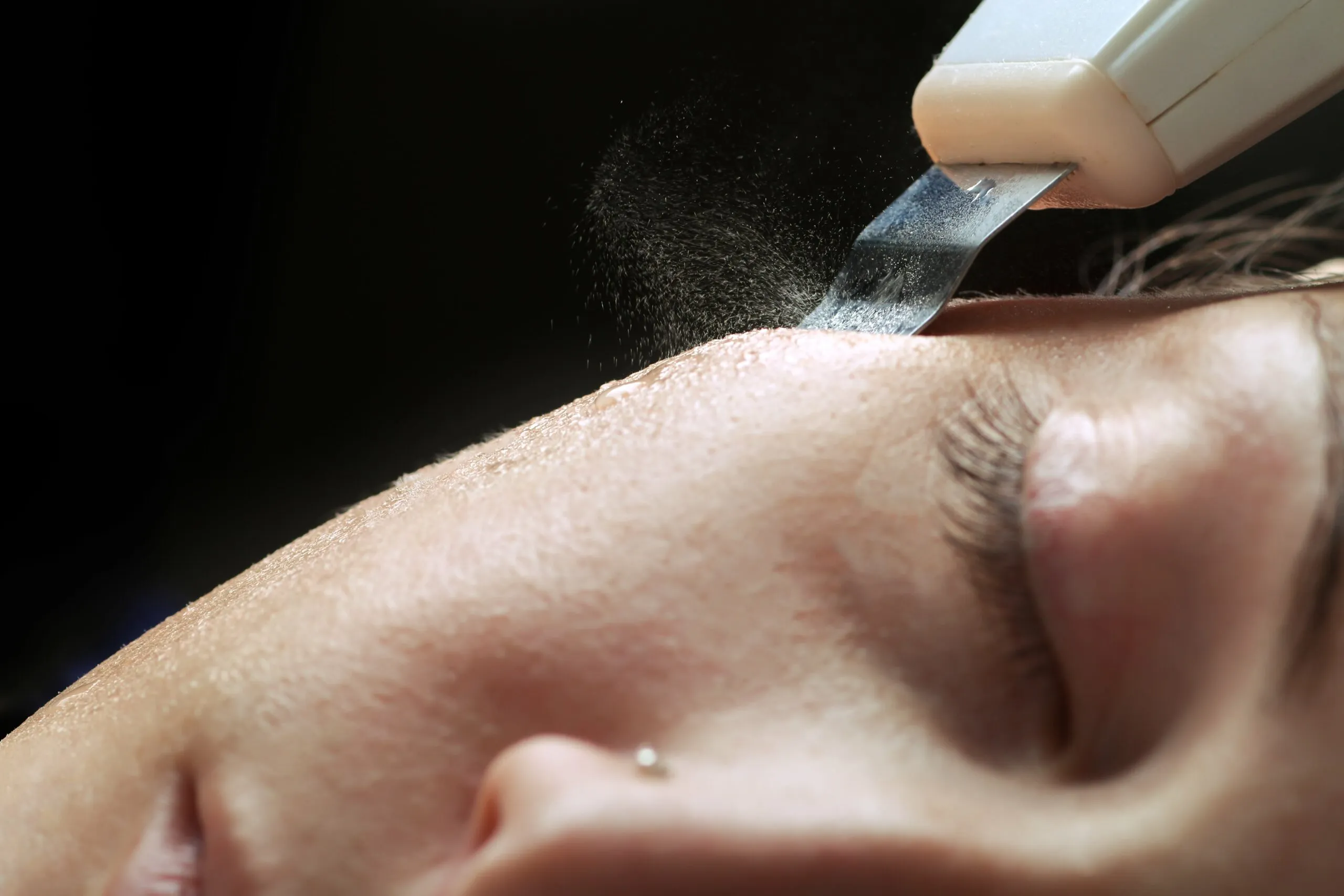 Femme se faisant faire une séance de peeling à l'institut Bendry